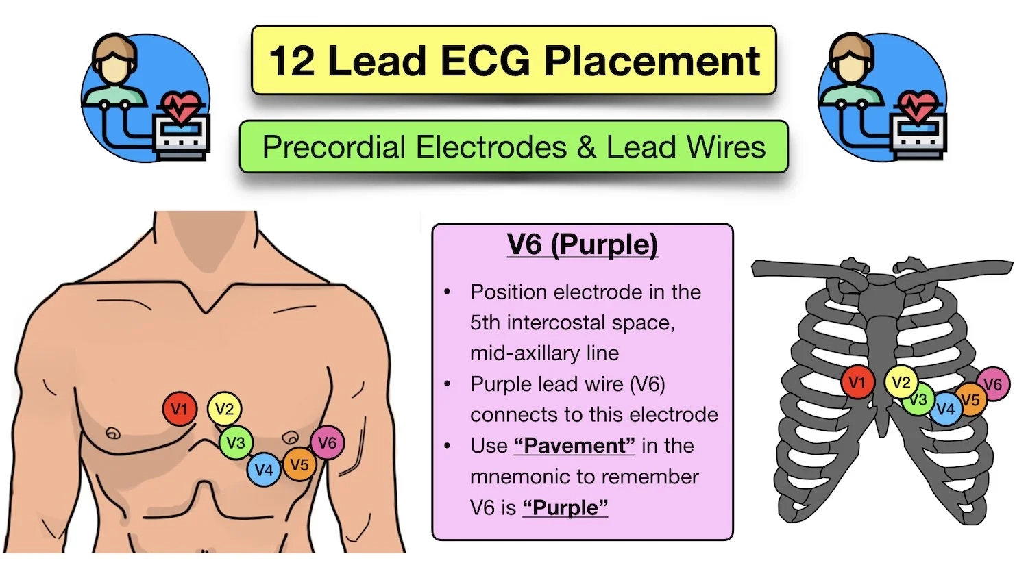 12 Lead ECG Placement Diagram And Mnemonic For Limb And Precordial Electrode Location EZmed 12 Lead ECG Placement Diagram And Mnemonic For Limb And Precordial Electrode Location EZmed