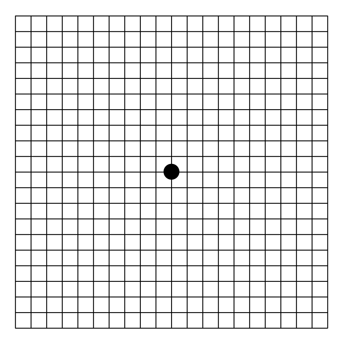 Amsler Grid Wikipedia