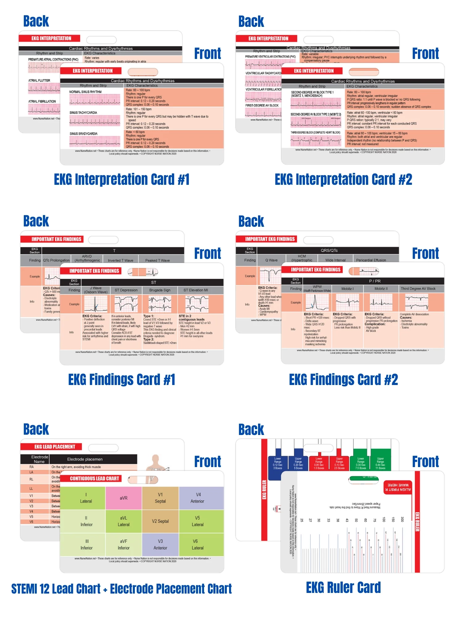 Printable 12 Lead Ecg Cheat Sheet Printable 12 Lead Ecg Cheat Sheet