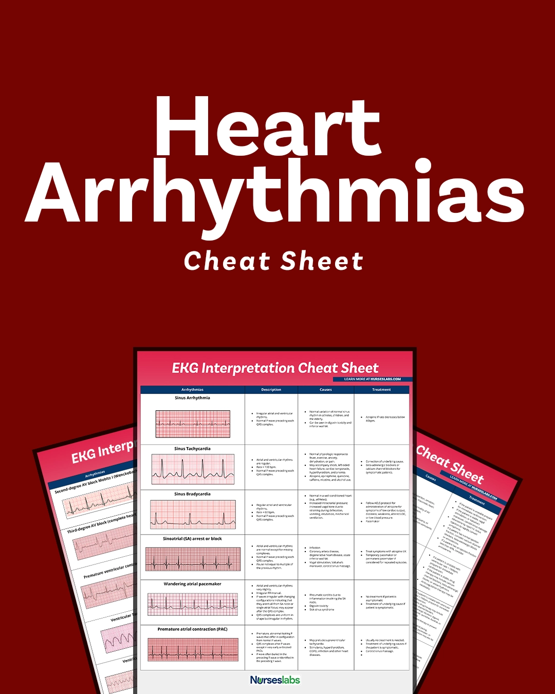 EKG Interpretation Cheat Sheet Heart Arrhythmias Guide 2020 Update EKG Interpretation Cheat Sheet Heart Arrhythmias Guide 2020 Update
