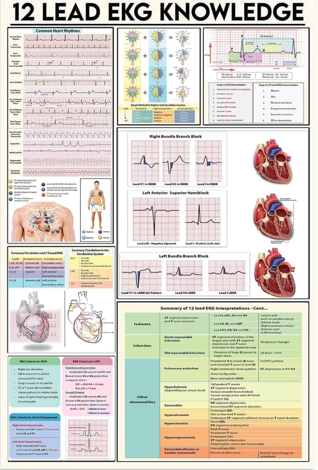 Printable 12 Lead Ecg Cheat Sheet