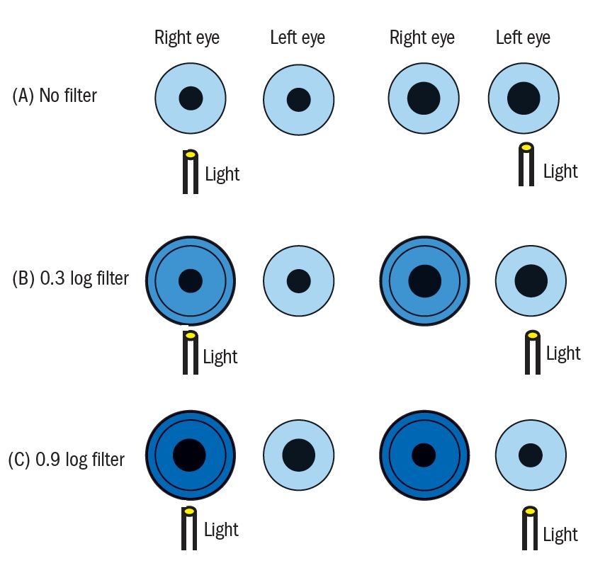 Optician Online CPD Archive Optician Online CPD Archive