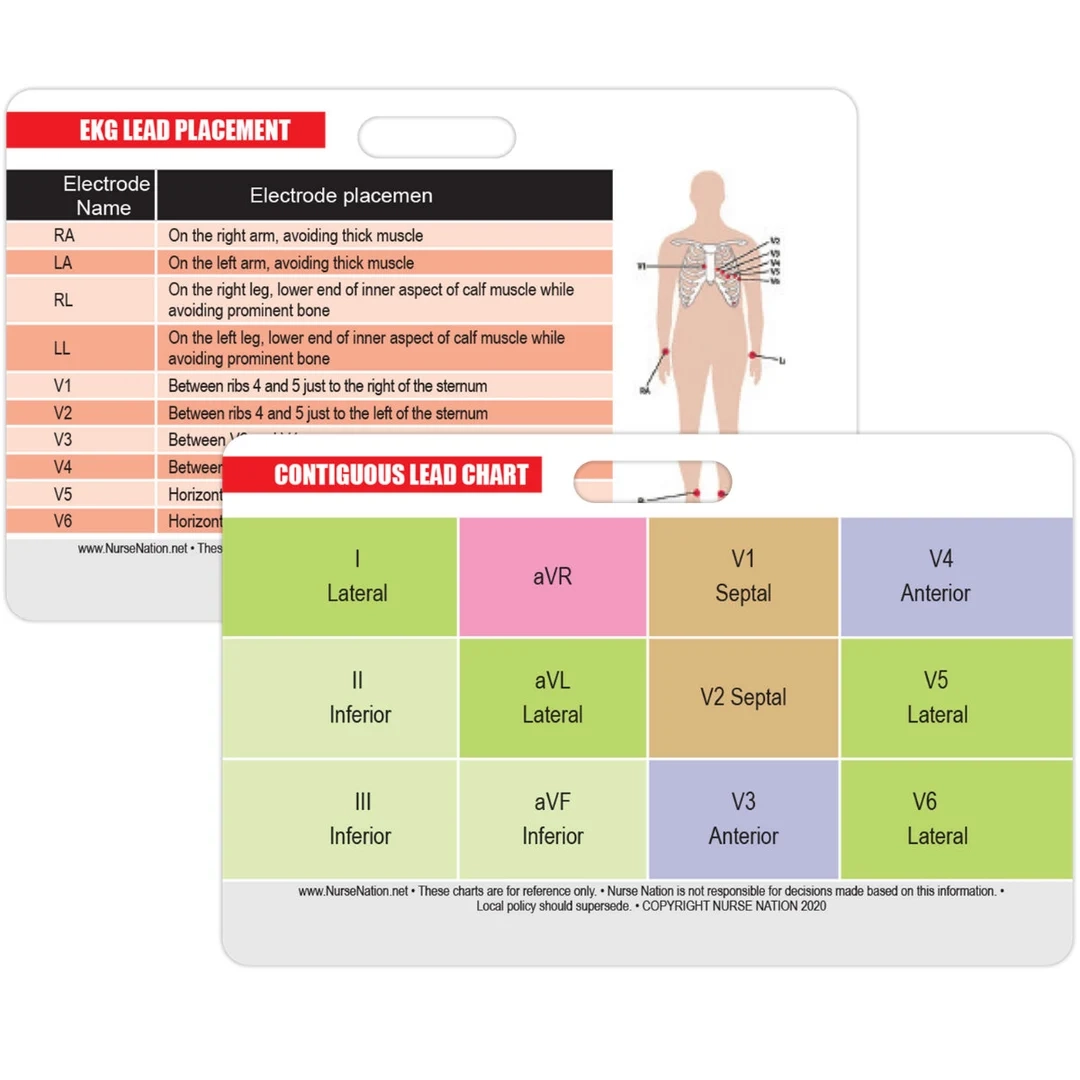 STEMI 12 Lead Reference And 12 Lead EKG ECG Placement Reference Horizontal Badge Card Etsy UK STEMI 12 Lead Reference And 12 Lead EKG ECG Placement Reference Horizontal Badge Card Etsy UK