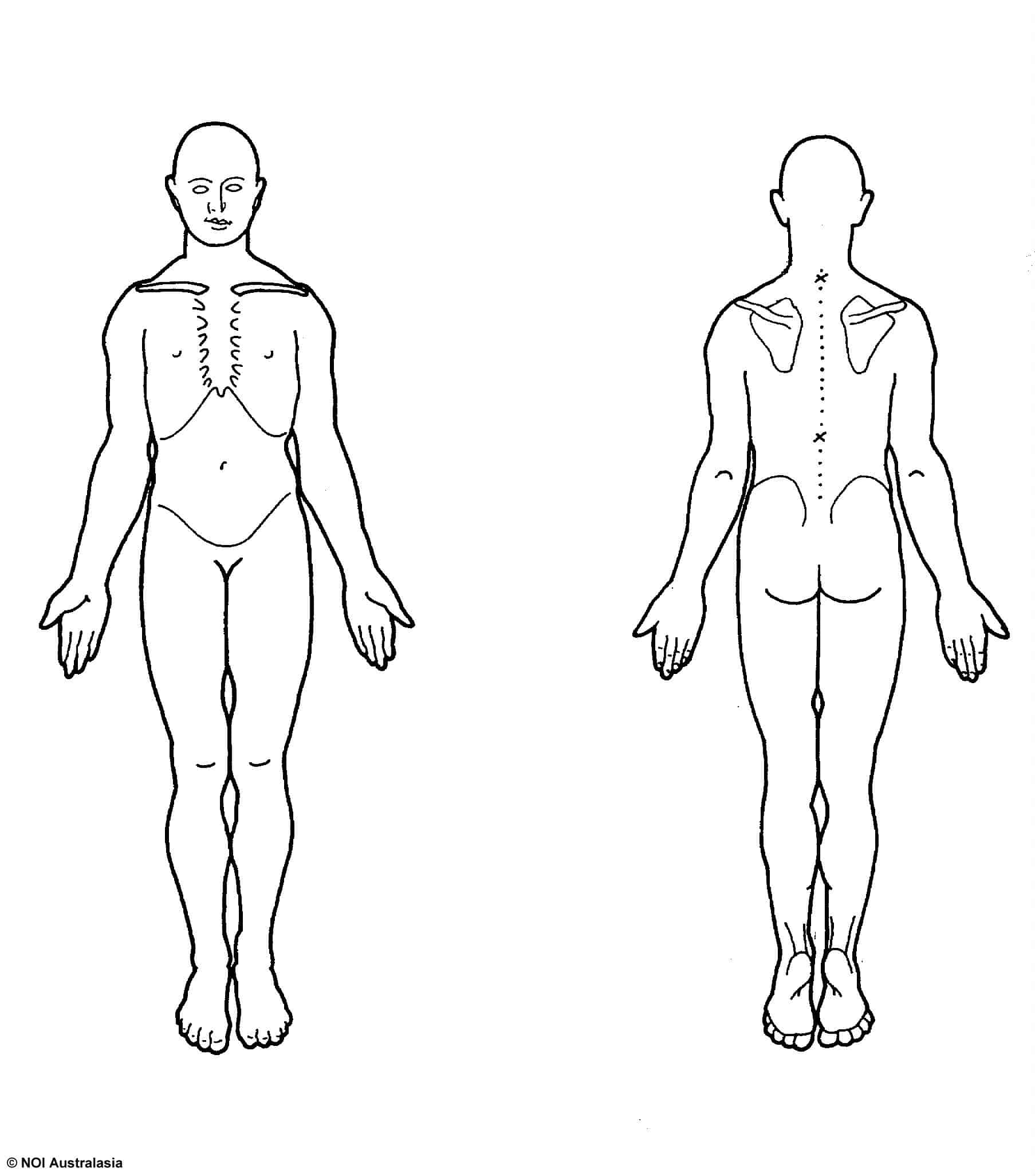 Printable Body Chart Physiotherapy
