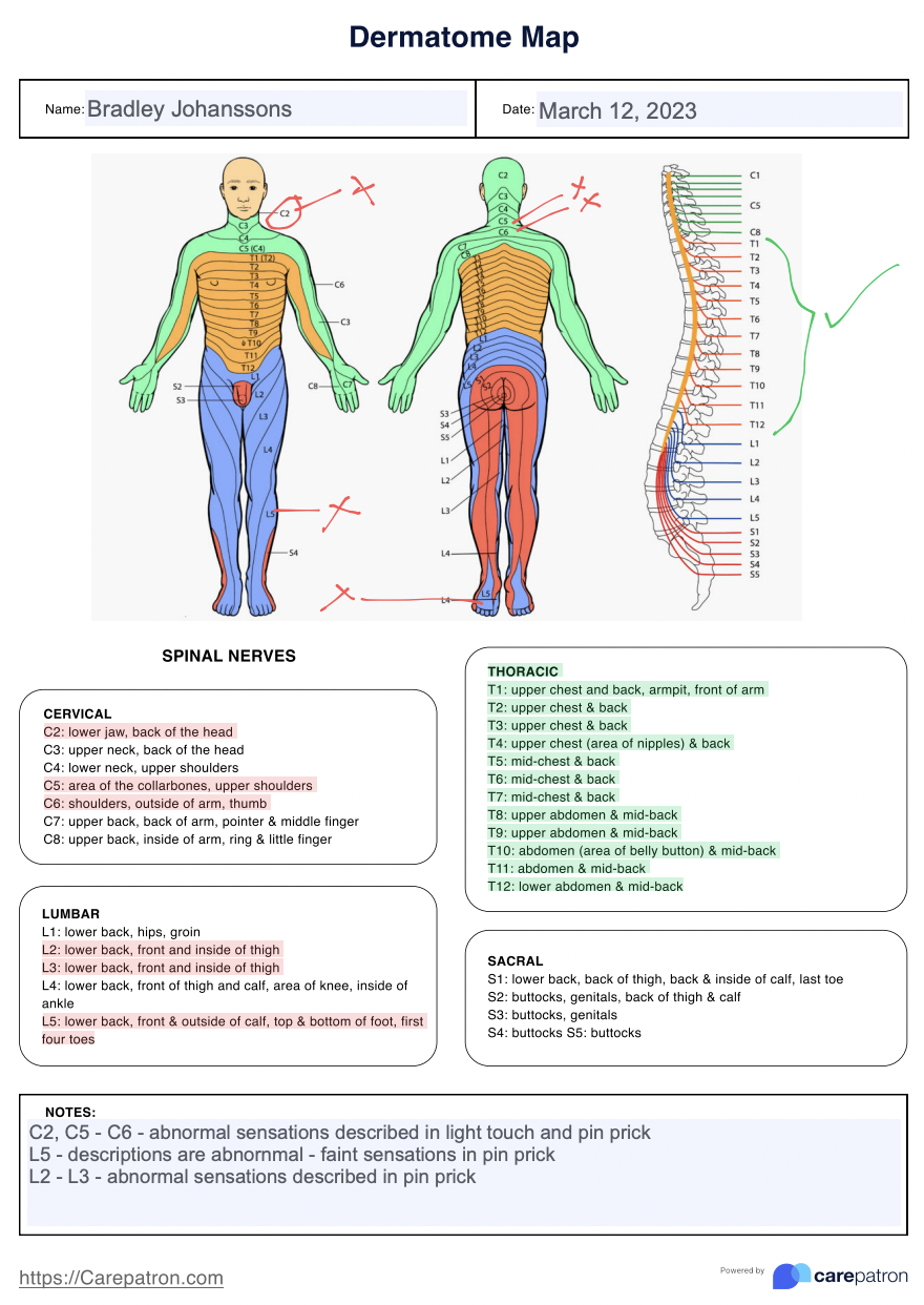 Printable Dermatome Map