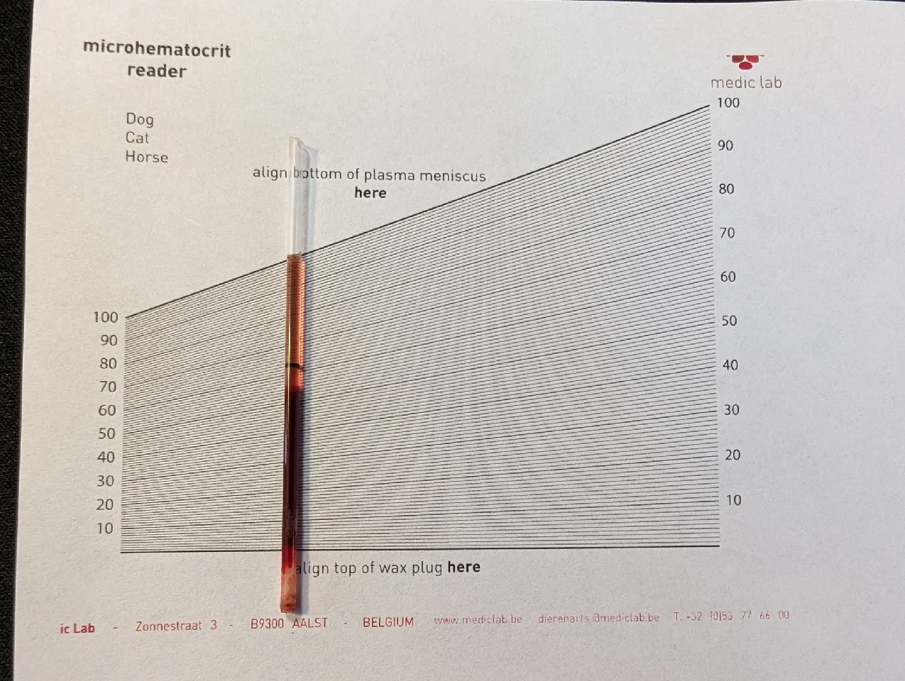 Hand powered Blood Sample Centrifuge By Antonio Download Free STL Model Printables
