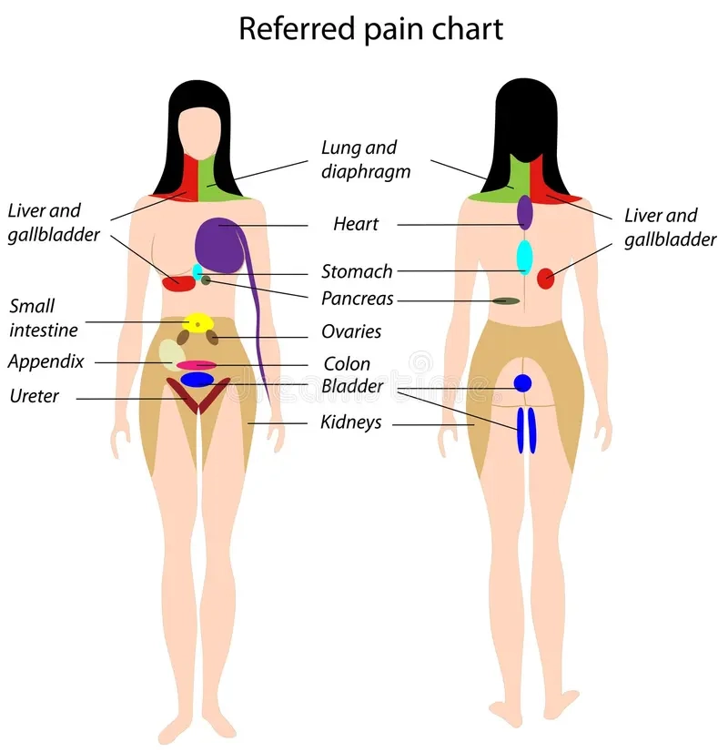 Printable Body Pain Chart